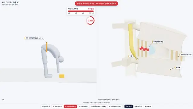 허리 디스크와 자세 6가지 3D 화면